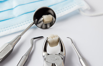 Tooth Removal and Extractions