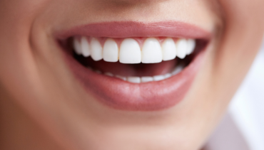 Teeth Whitening near Box Hill