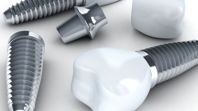Banish Uncomfortable Bridges And Unsightly Gaps With Tooth Implants