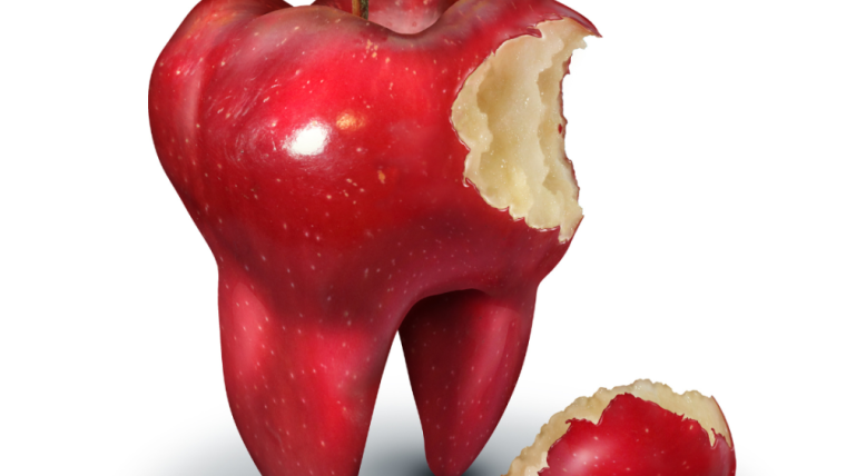 How to avoid chipping your teeth and what to do if it happens