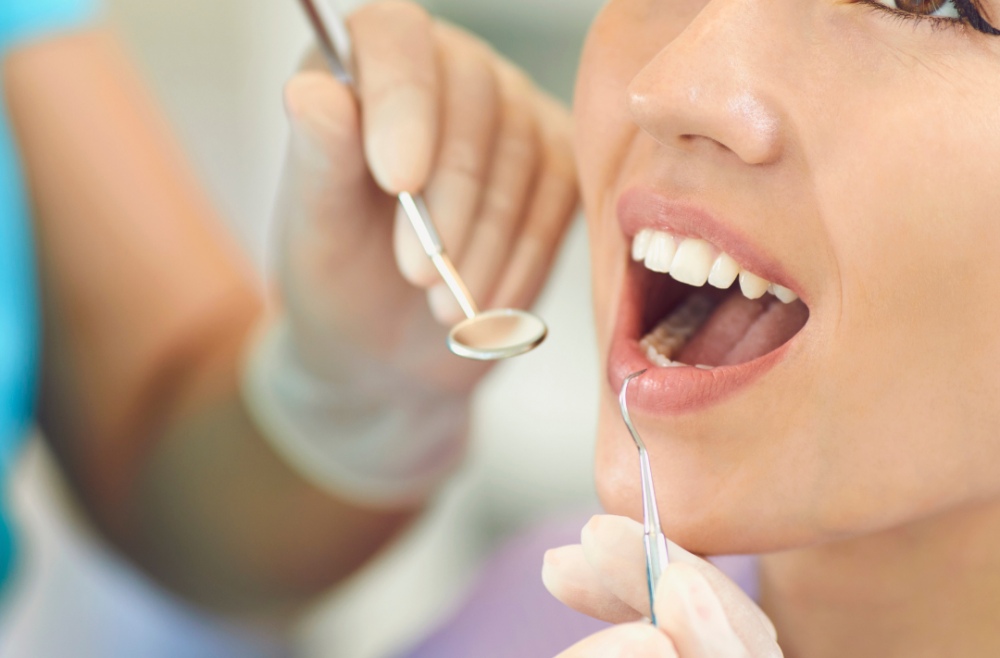 Have Your Teeth Had A Deep Clean Lately?