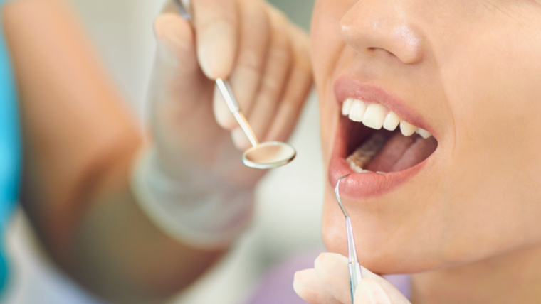 Have Your Teeth Had A Deep Clean Lately?