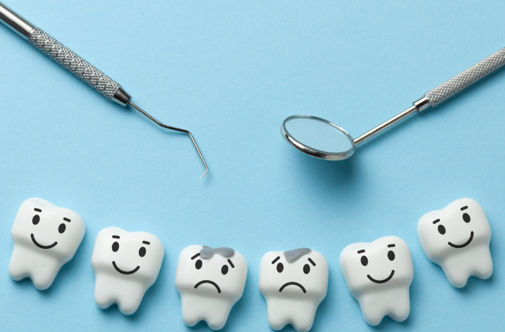 Considering White Fillings? Here’s What You Need To Know