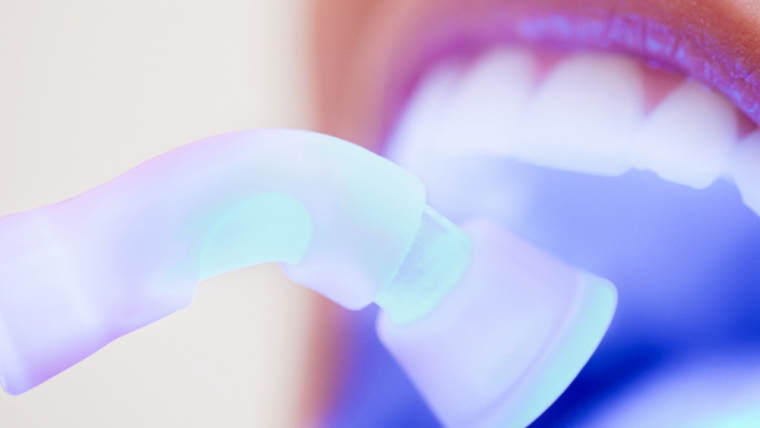 Dental Fillings