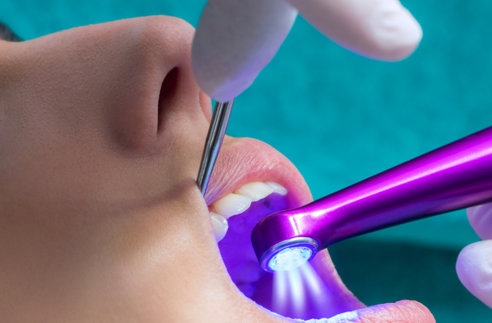 Have you got questions about dental fissure sealant?