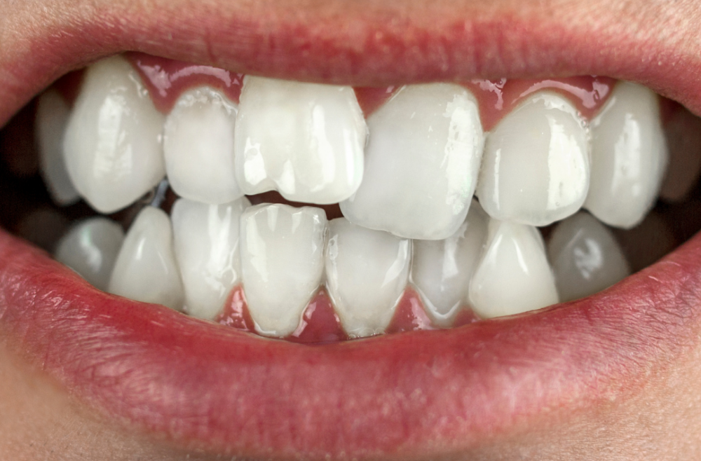 Orthodontics