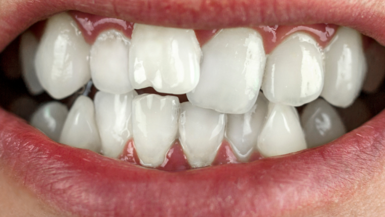 Orthodontics