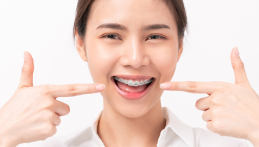 Dental Crowns