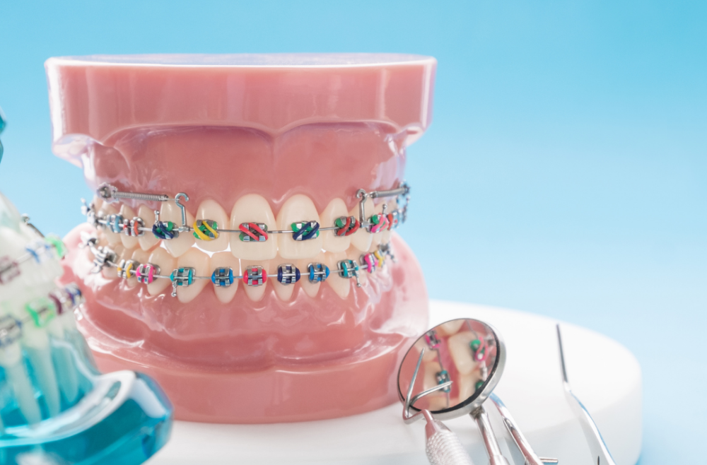 What is the difference between an Orthodontist and a Dentist?