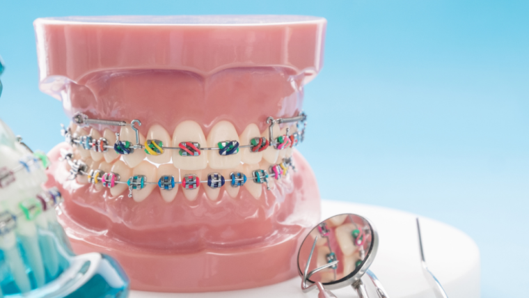What is the difference between an Orthodontist and a Dentist?