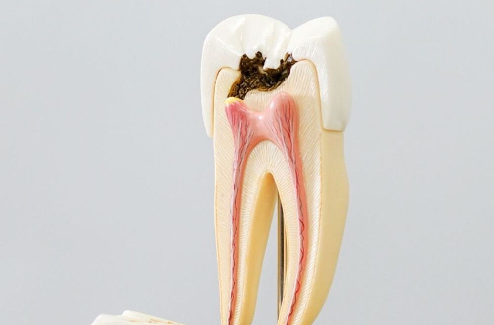 What is tooth pain signaling, and what should you do about it