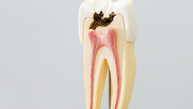 What is tooth pain signaling, and what should you do about it