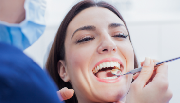 Tooth Removal and Extractions