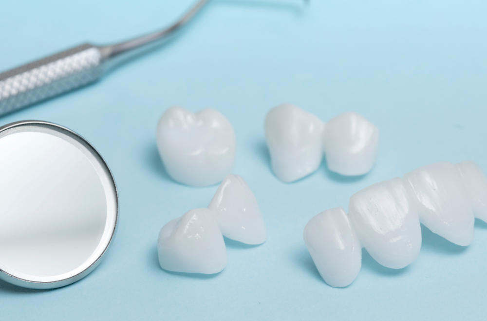 Are Veneers The Right Option For Me?