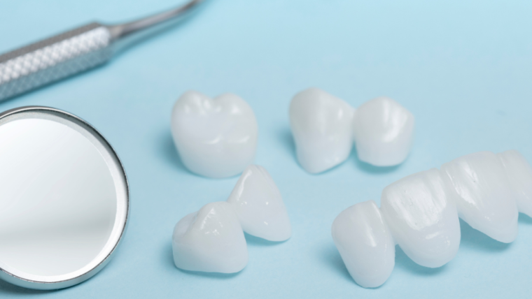 Are Veneers The Right Option For Me?