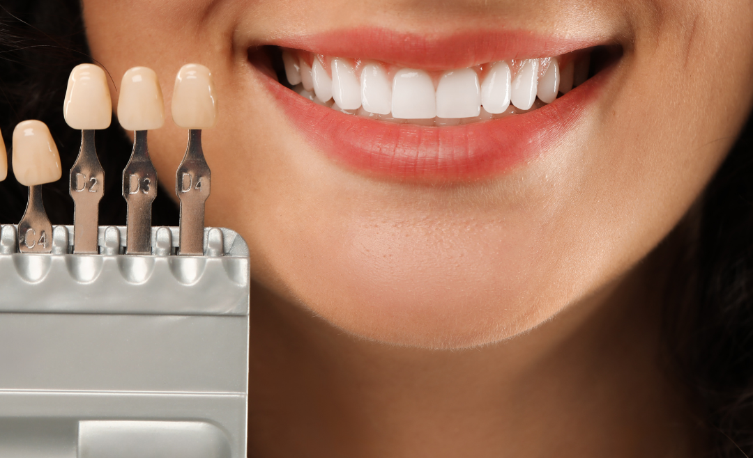 A Guide to the Most Popular Cosmetic Dental Treatments