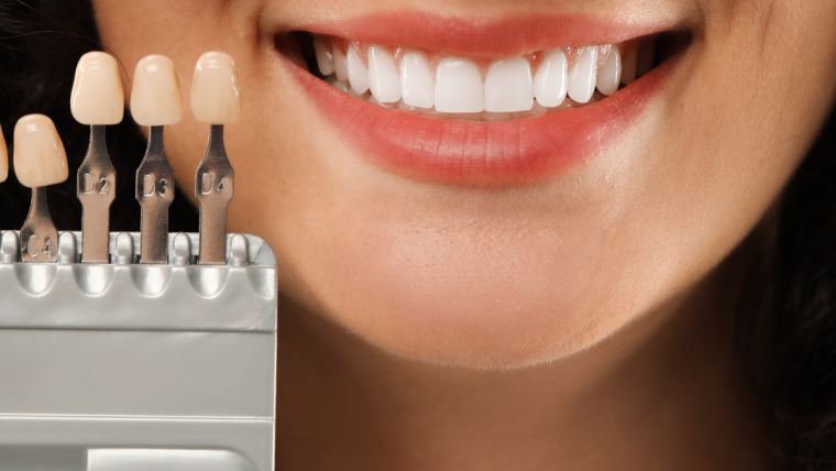 A Guide to the Most Popular Cosmetic Dental Treatments