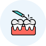 Teeth Cleaning