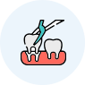 Tooth Extraction