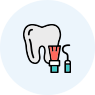 Fluoride Treatment