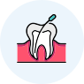 Root Canal
